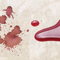 Пропитка защитная Tenax Proseal 1 л водо масло грязеотталкивающая для натурального и искусственного камня